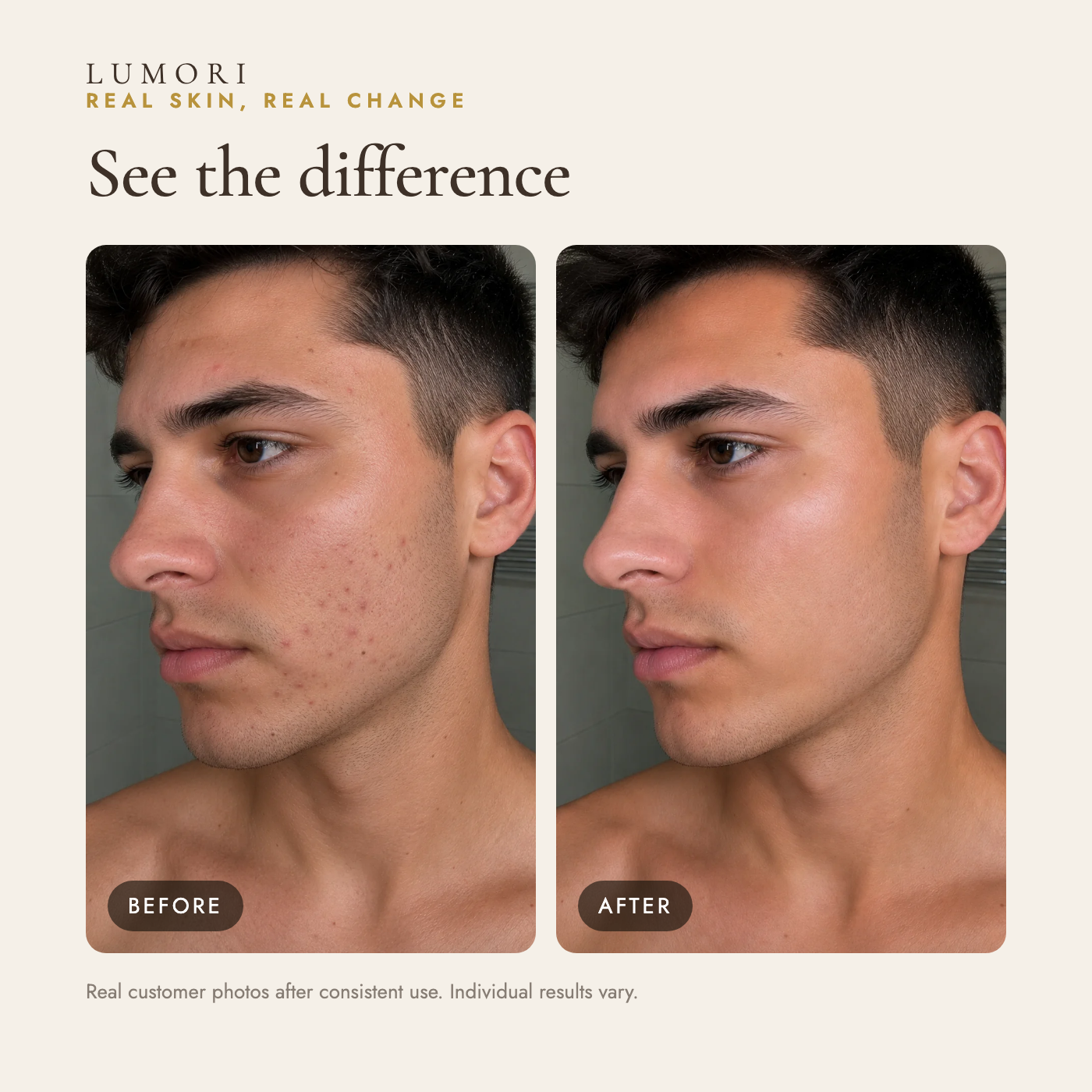 Before and after — real customer