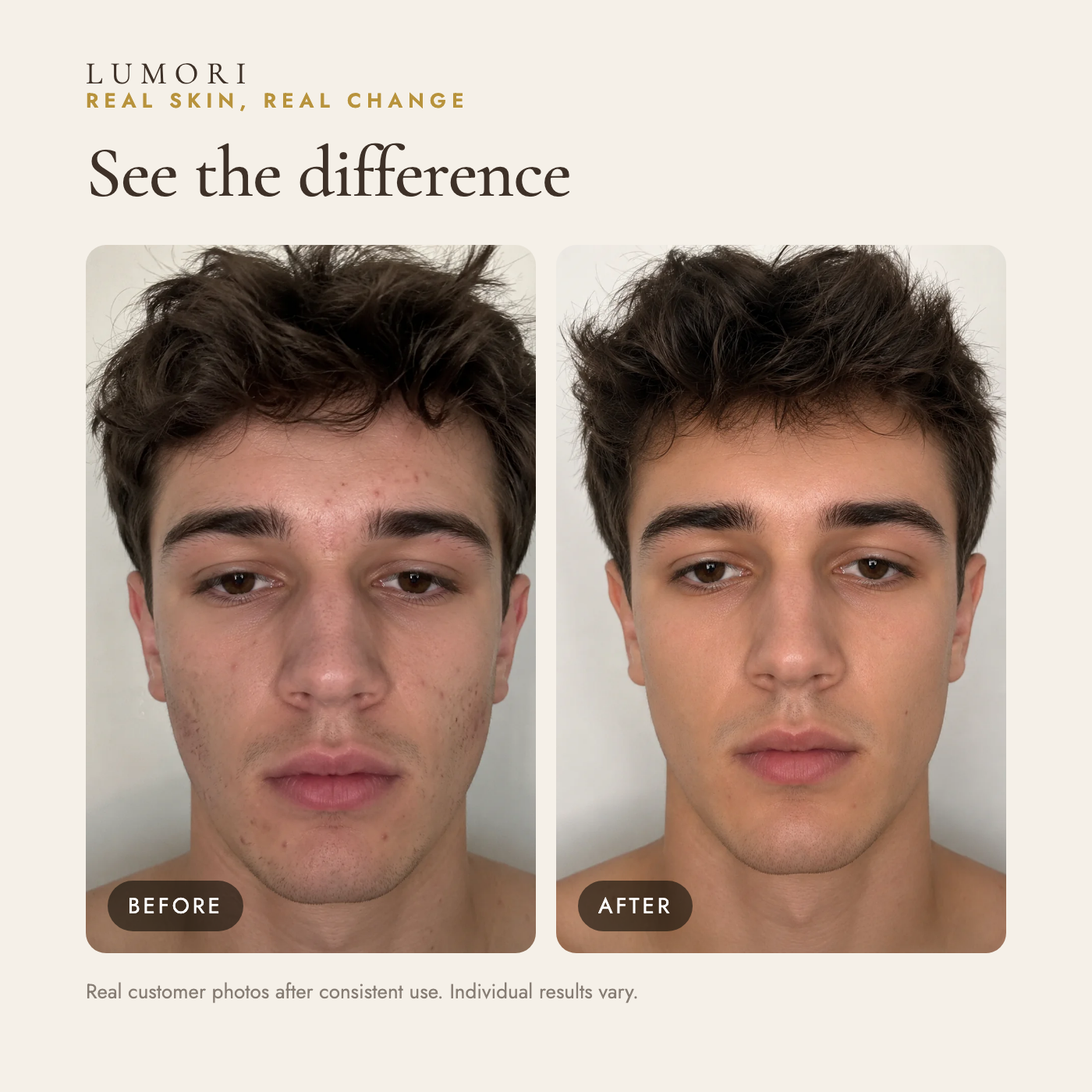 Before and after — real customer