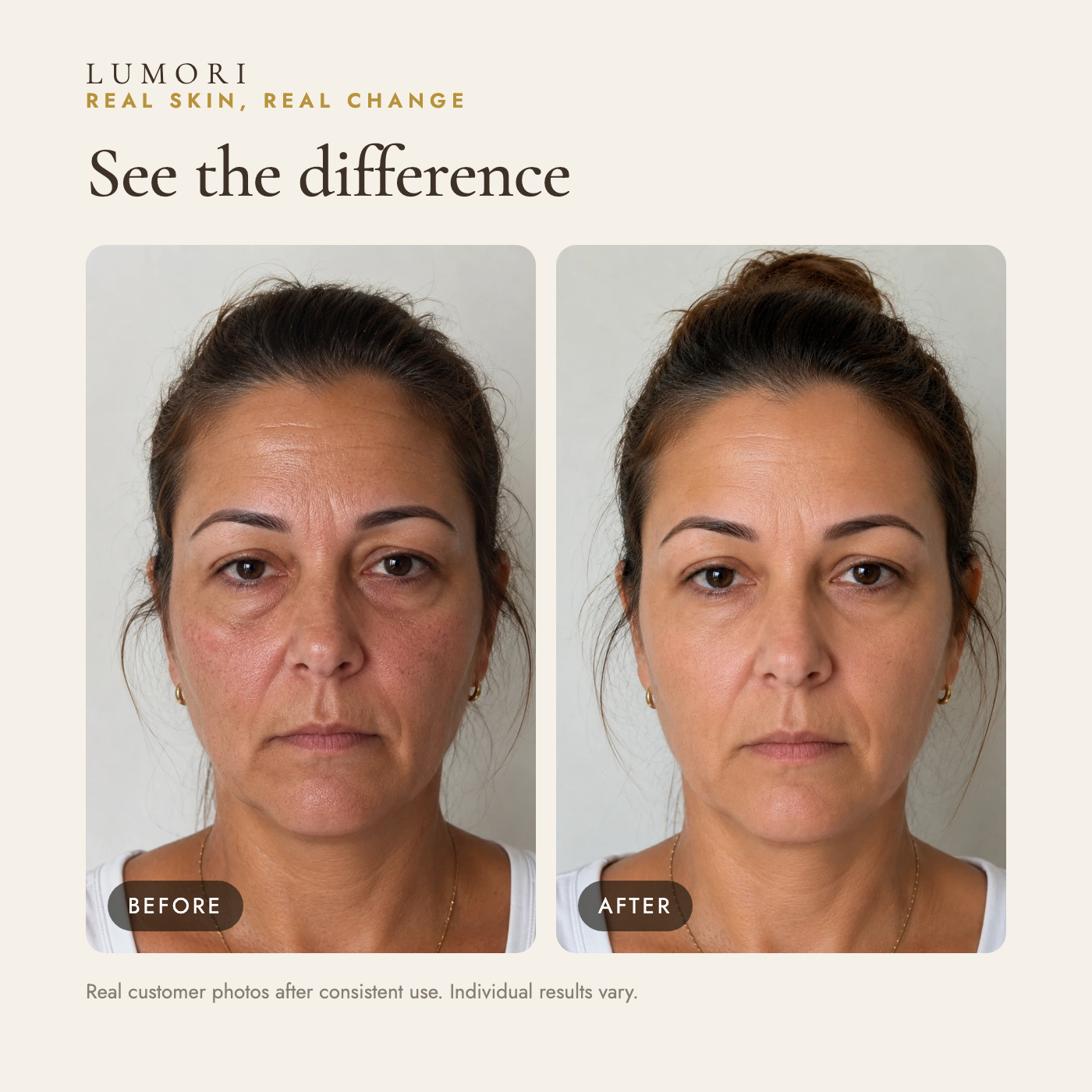 Before and after — real customer