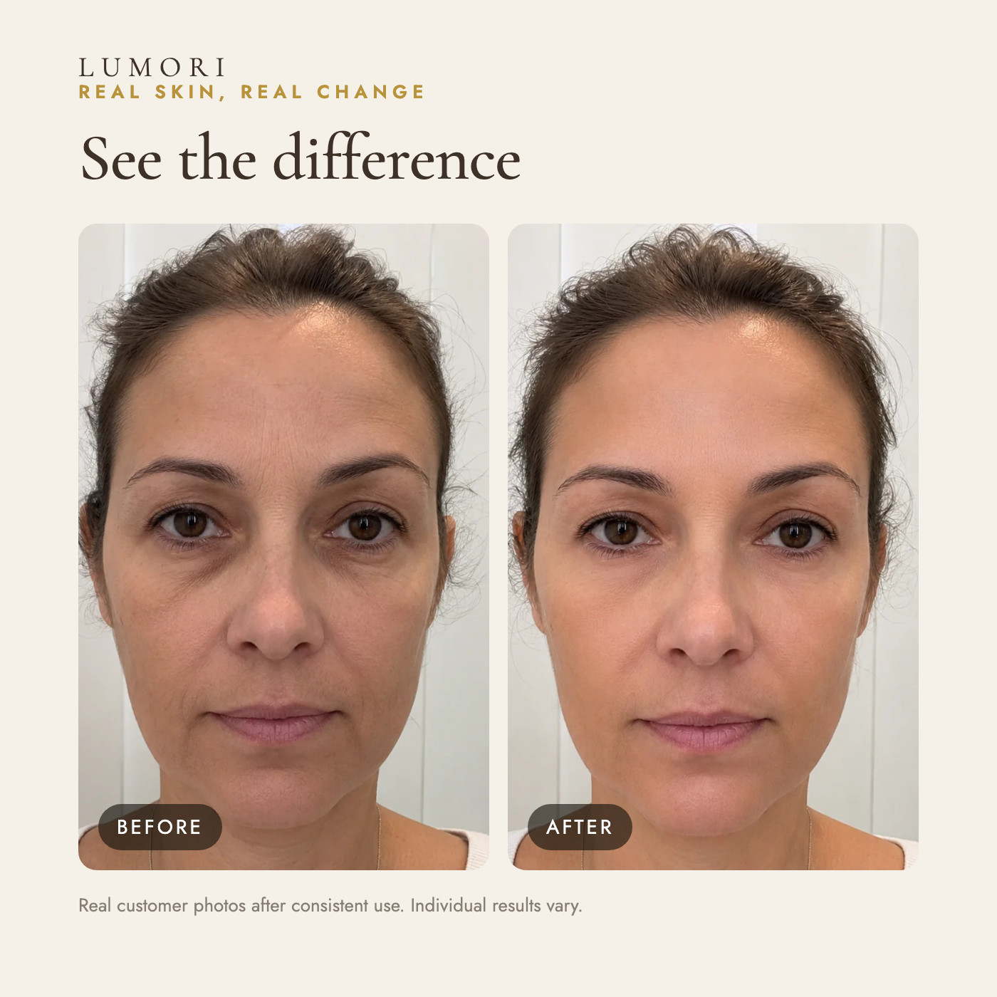 Vitamin C Serum before and after — real customer